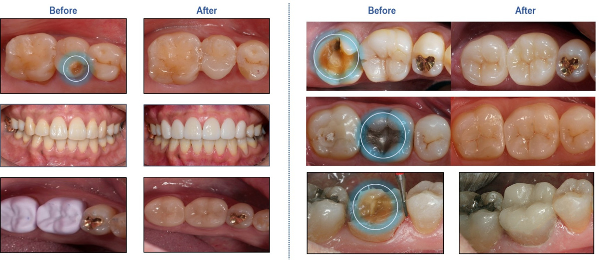 clinic case3.jpg clinic case3.jpg