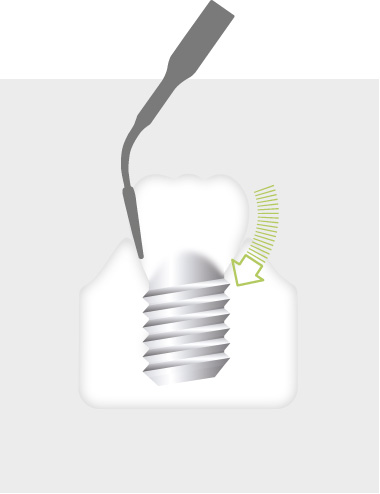 Tip_1I_-_Tooth_illustration_Image_000491_03_150dpi.jpg