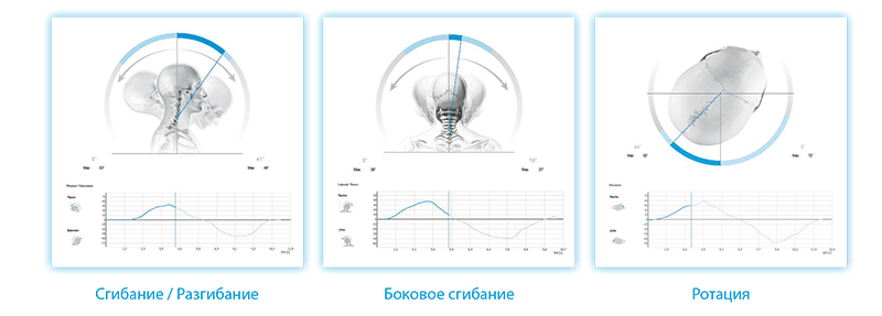 DIERS-20.jpg DIERS-20.jpg