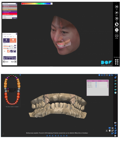 Этап № 5 Дизайн реставрации с 3D-визуализацией лица..png