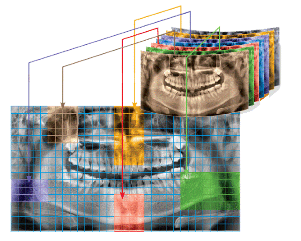 MagicPan компьютерного томографа PaX-i 3D