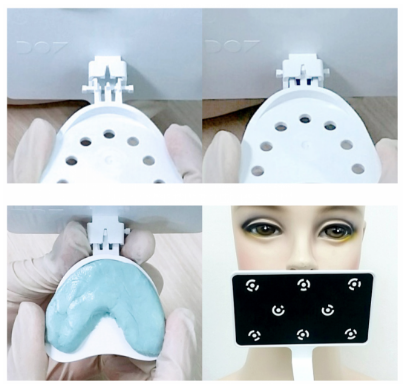 Этап № 3 Сканирование прикуса в лабораторном сканере. .png