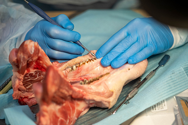 Направленная костная регенерация6.jpg