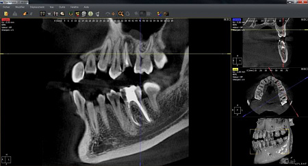 Owandy I-Max Touch 3D – Конусно-лучевой томограф 9х8