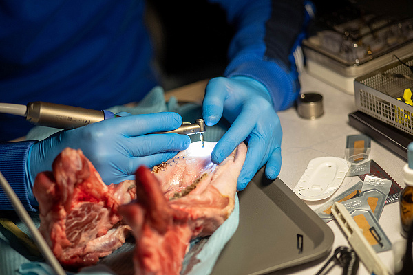 Направленная костная регенерация16.jpg