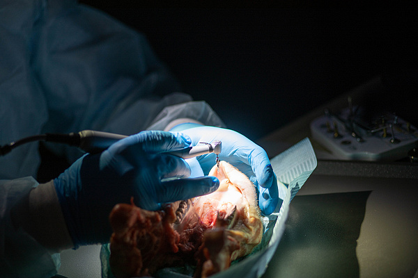 Направленная костная регенерация13.jpg