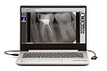 New Life Radiology Mercury DIGISENS - цифровой радиовизиограф с ноутбуком
