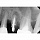 Acteon SAG SOPIX2 - система компьютерной визиографии (стоматологический визиограф)